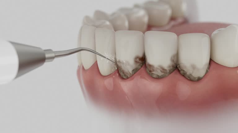 Reliable Dental Implants contractor in New Richmond, WI by Smile Center Dentistry